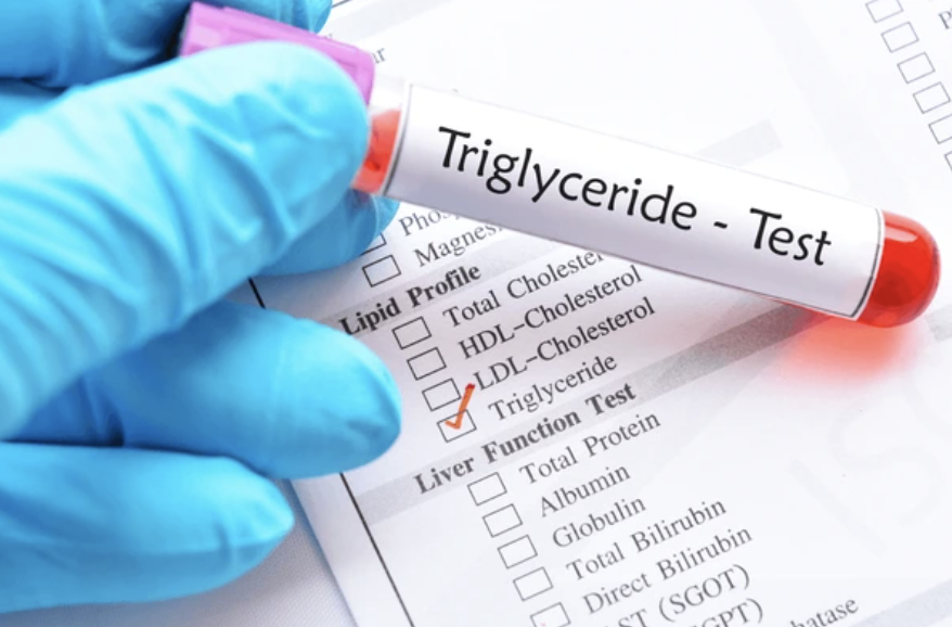 Triglycerides test