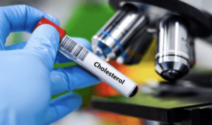 cholesterol