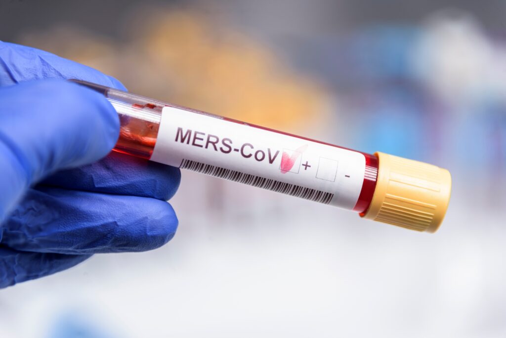 MERS