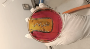 salmonella