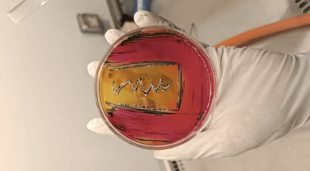 salmonella