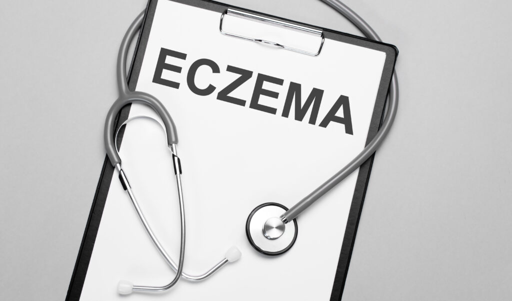 Eczema