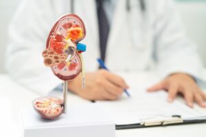 Kidney