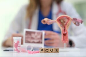 pcos