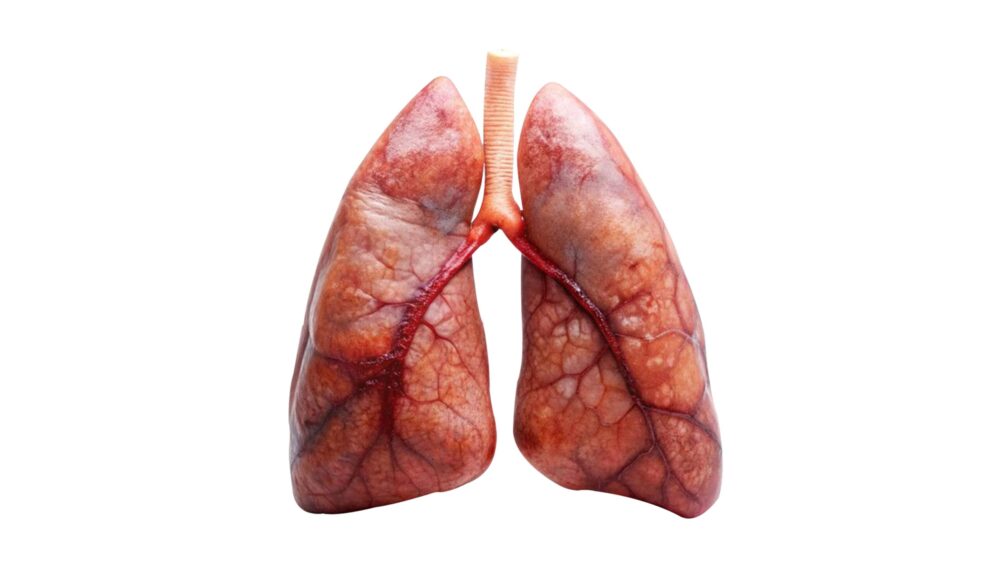 Lungs