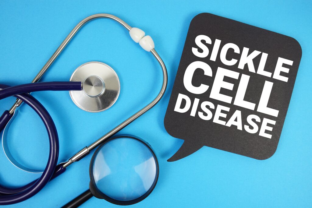 Sickle,Cell,Disease