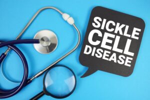 Sickle,Cell,Disease