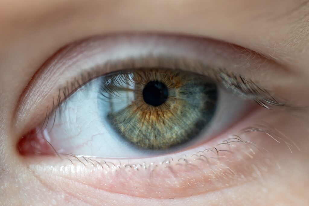vision