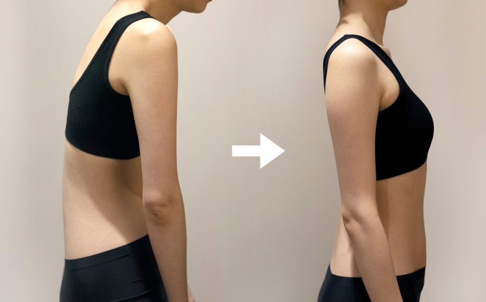 Posture