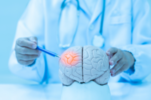 Hydrocephalus
