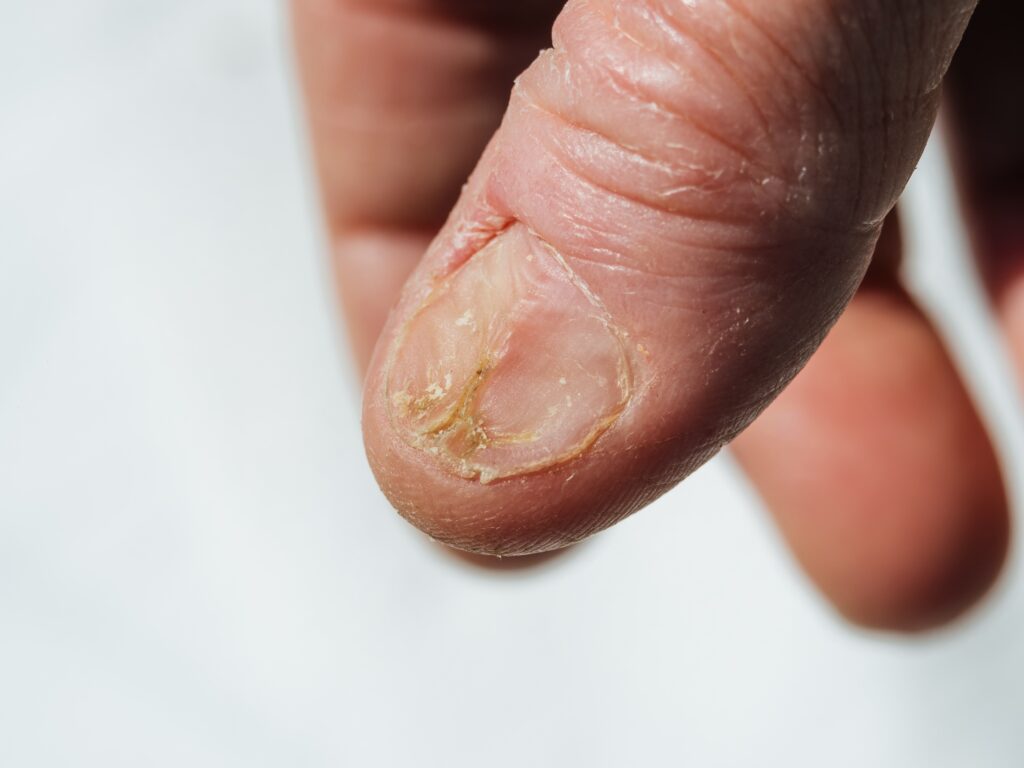 nail