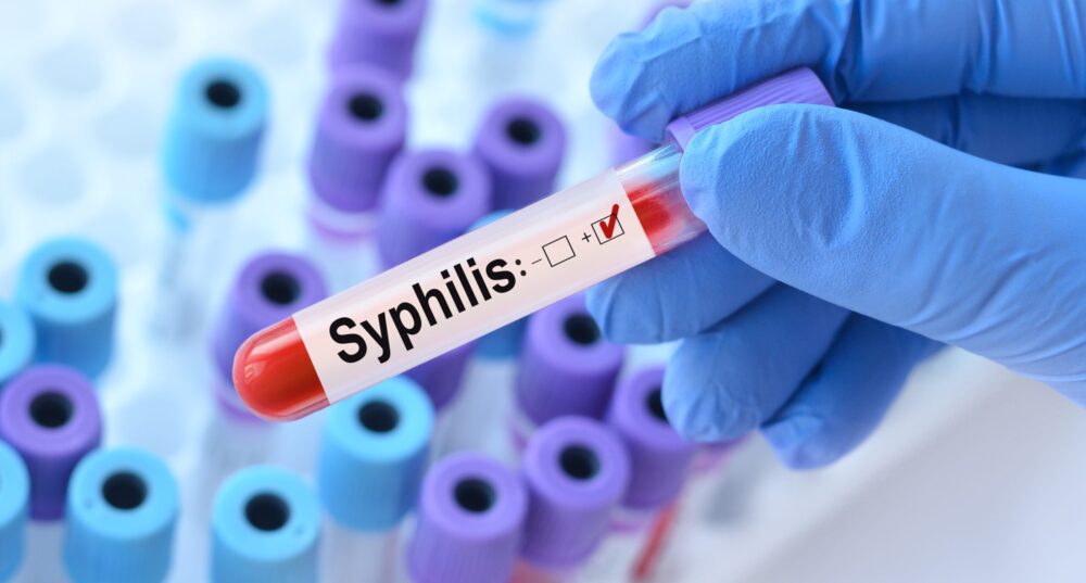 syphilis
